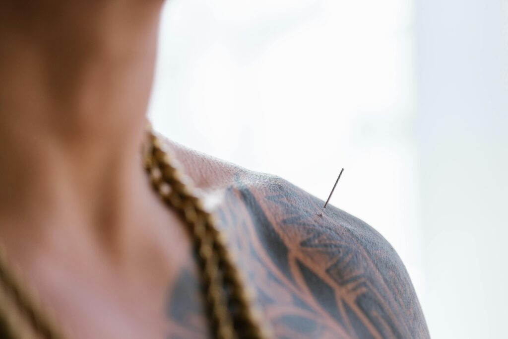 pexels-photo-8312849-8312849 A detailed close-up of a tattooed shoulder with a needle inserted, highlighting body art and acupuncture.